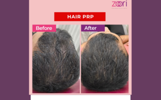 Before After transformations Skin clinic IG Post (540 x 405 px) (1)