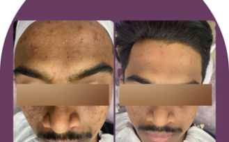 zoori website before after 2