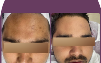 zoori website before after 3