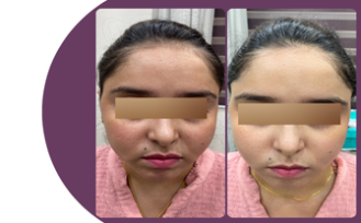 zoori website before after 7