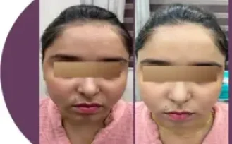 zoori-website-before-after-7-r2zh3gy3edn88sqrpetjyfwc52qp4j2l5ilfjq69mge