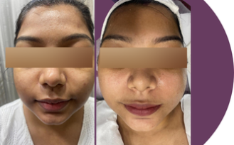 zoori website before after